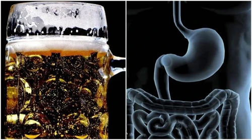 beer guts